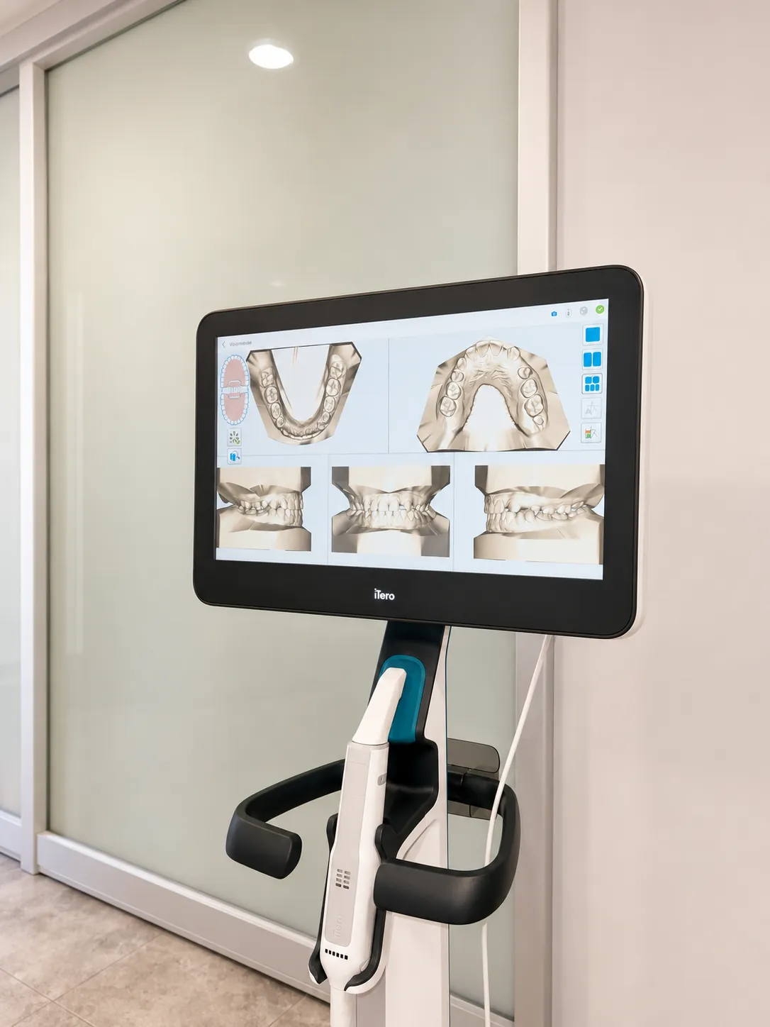 Empreinte numérique 3D au cabinet du Dr Durieux
